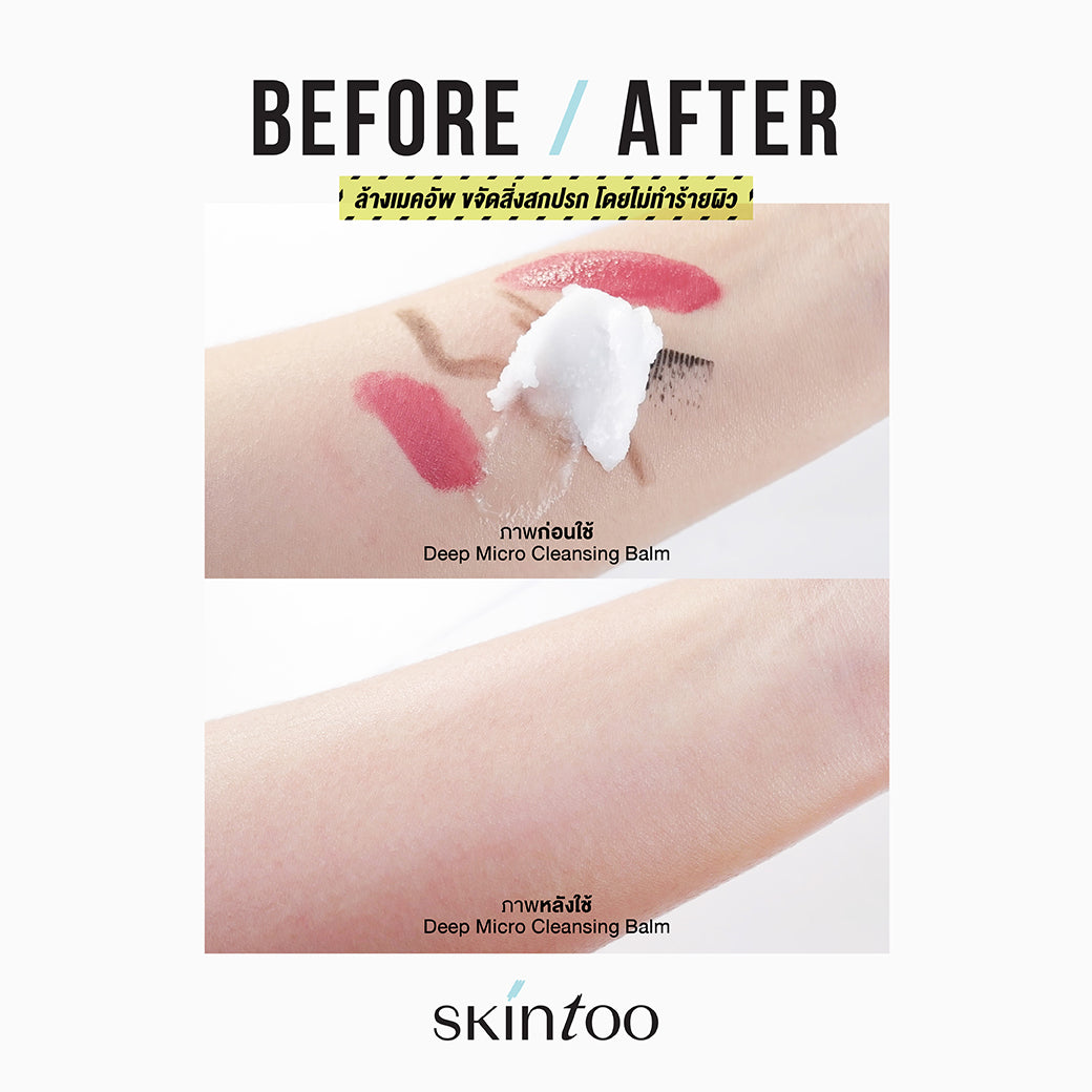 [เซ็ต2ชิ้น] บาล์มคลีนผิว ทำความสะอาดเมคอัพ - SKINTOO DEEP MICRO CLEANSING BALM 90G